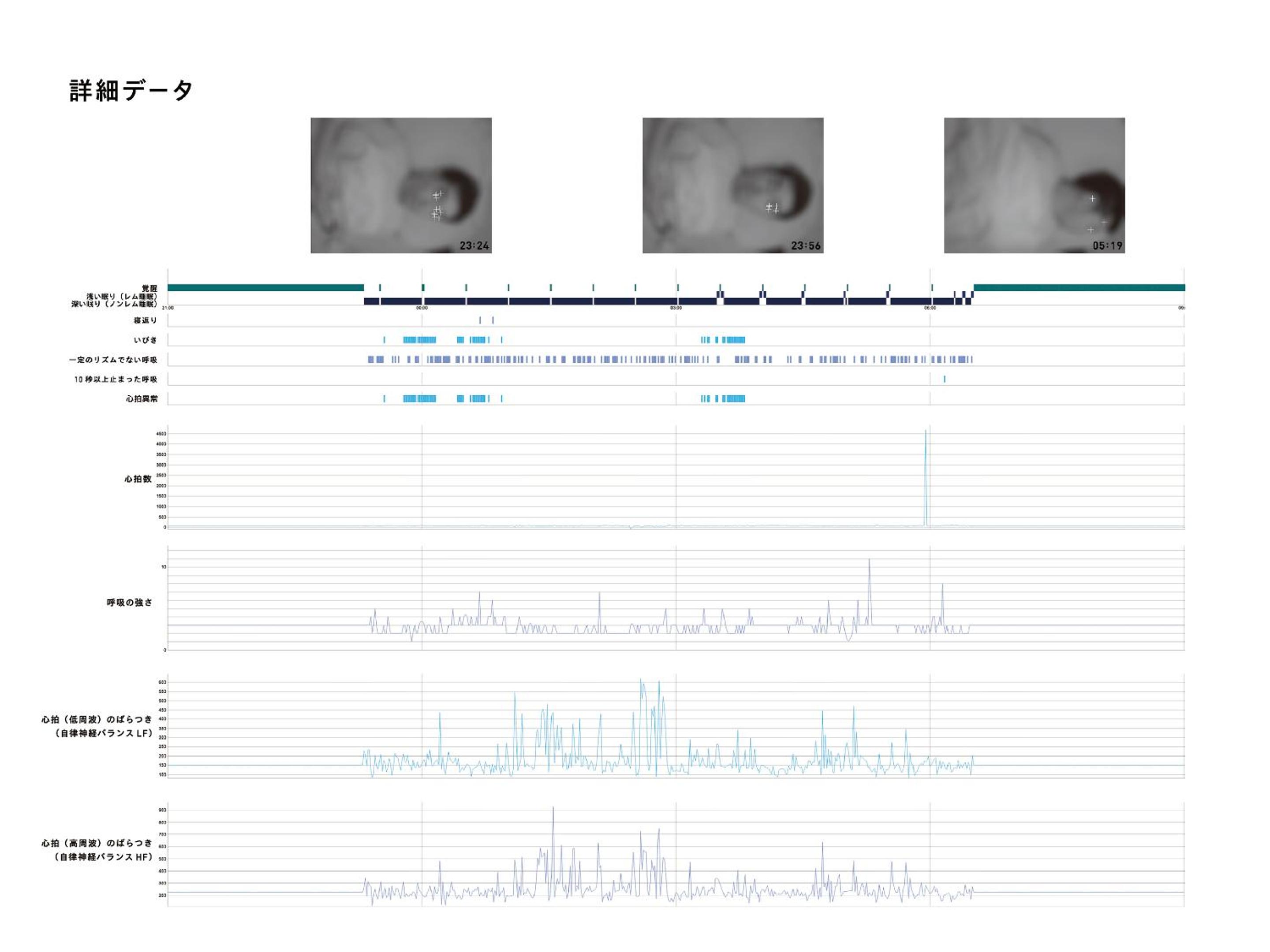 Special Offer - Capsule Room for Female - Sleep Report Included photo 3